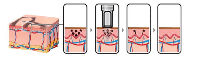 A eficiência do pulso em 6ns