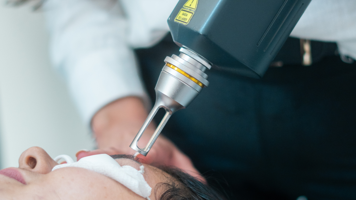 Aluguel de Laser ND-YAG: Benefícios, Valores e Por que Locar para Sua Clínica de Estética