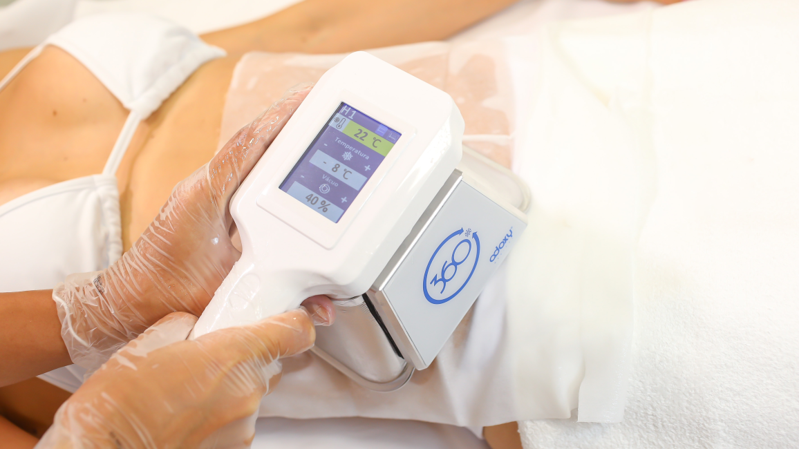 Criolipólise Asgard VC9 e VC10: Tecnologia Avançada para Redução de Gordura Localizada