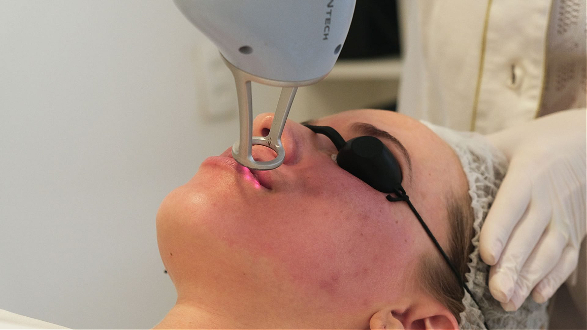 Por que o Laser Lavieen é ideal para sua clínica?