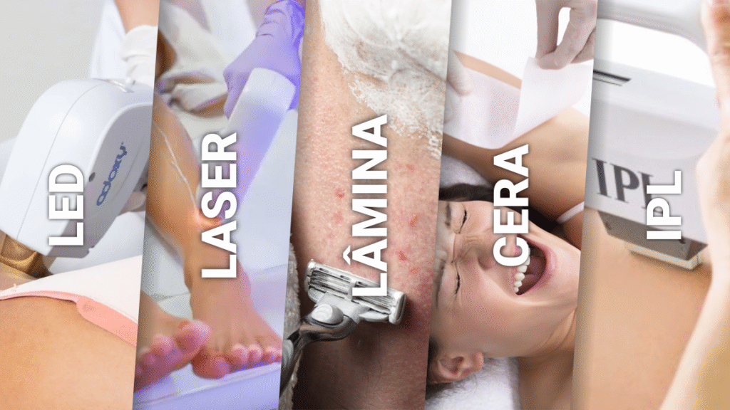 Qual o melhor método de depilação hoje?